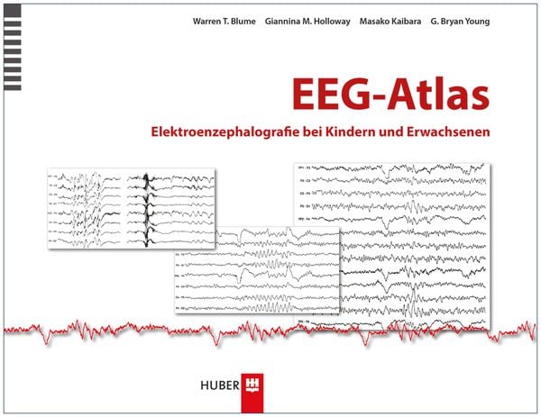EEG-Atlas, Gebundene Ausgabe von Warren Thomas Blume , Giannina M. Holloway , Masako Kaibara , G. Bryan Young, Hogrefe AG, 9783456852645
