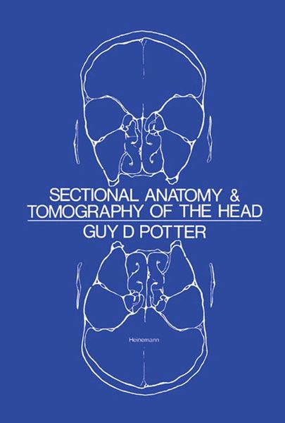 Produktbild: Sectional Anatomy and Tomography of the Head