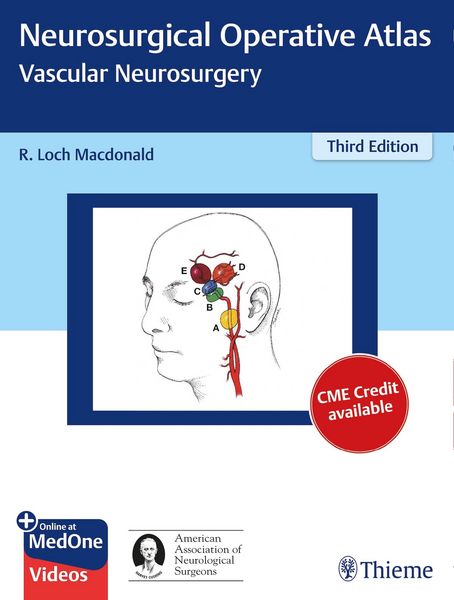 Produktbild: Neurosurgical Operative Atlas: Vascular Neurosurgery