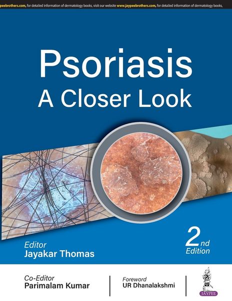 Produktbild: Psoriasis