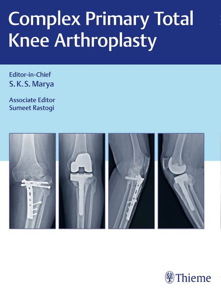 Produktbild: Complex Primary Total Knee Arthroplasty