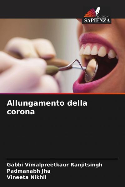 Produktbild: Allungamento della corona