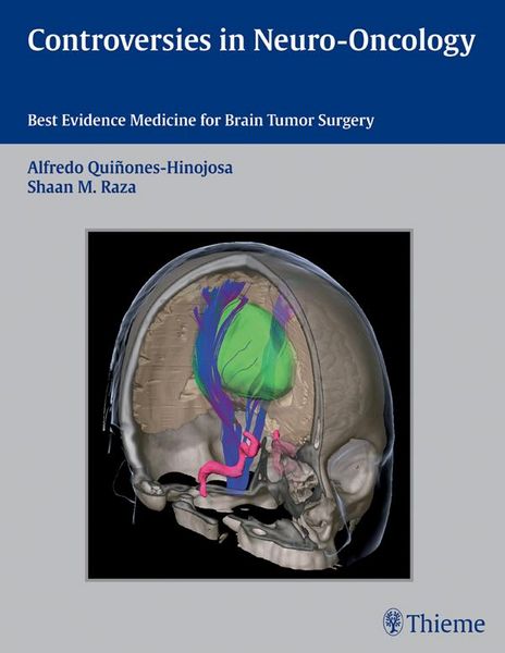 Produktbild: Controversies in Neuro-Oncology