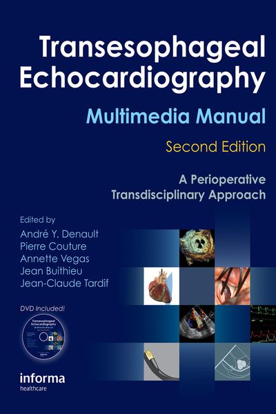 Produktbild: Transesophageal Echocardiography Multimedia Manual