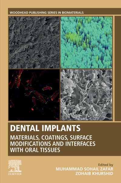 Produktbild: Dental Implants
