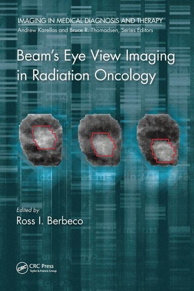 Produktbild: Beam's Eye View Imaging in Radiation Oncology