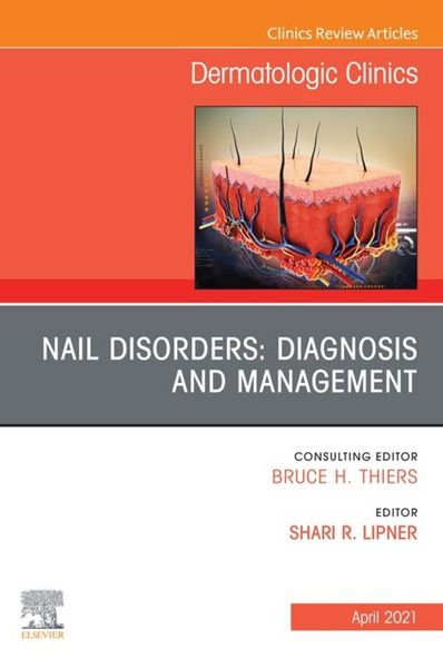 Produktbild: Nail Disorders: Diagnosis and Management, An Issue of Dermatologic Clinics