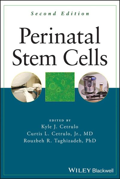 Produktbild: Perinatal Stem Cells