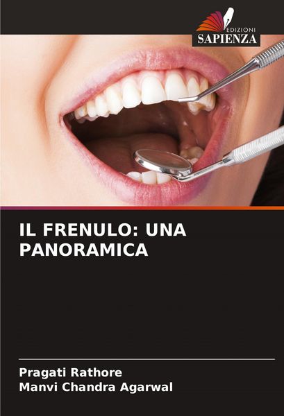 Produktbild: Il Frenulo: Una Panoramica