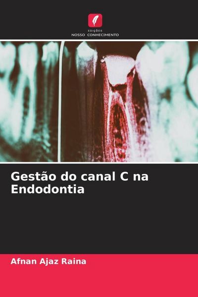 Produktbild: Gest&atilde;o do canal C na Endodontia