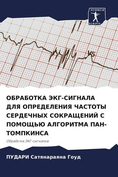 Produktbild: Obrabotka Jekg-Signala Dlya Opredeleniya Chastoty Serdechnyh Sokrashhenij S Pomoshh'ju Algoritma Pan-Tompkinsa