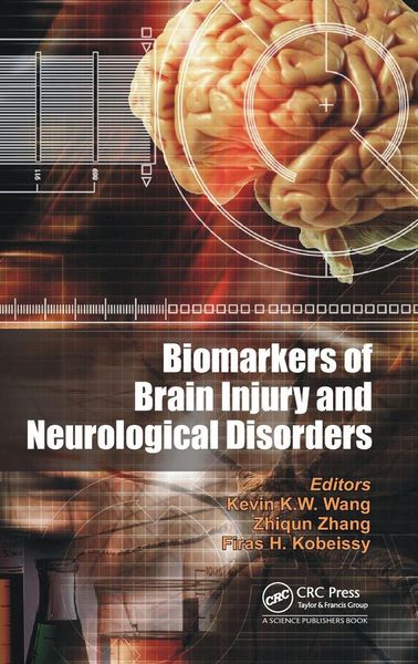 Produktbild: Biomarkers of Brain Injury and Neurological Disorders