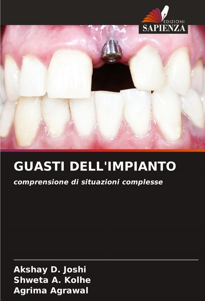 Produktbild: Guasti Dell'impianto