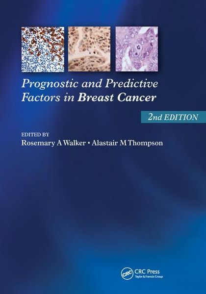 Produktbild: Prognostic and Predictive Factors in Breast Cancer