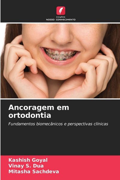 Produktbild: Ancoragem em ortodontia