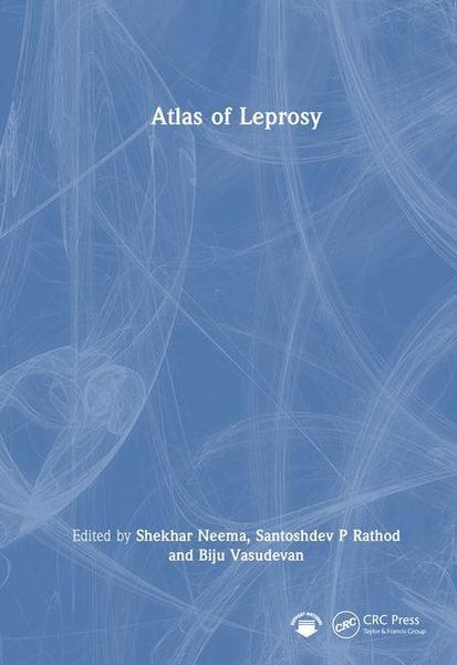 Produktbild: Atlas of Leprosy