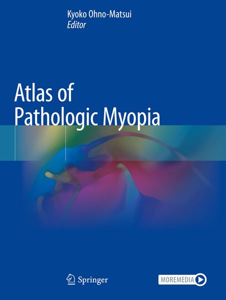 Produktbild: Atlas of Pathologic Myopia