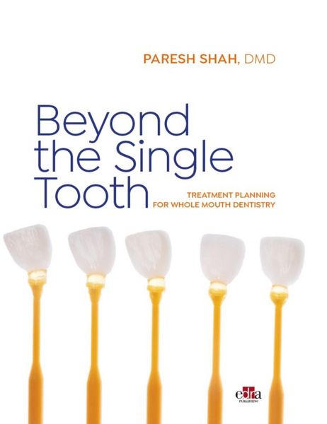 Produktbild: Beyond the single tooth