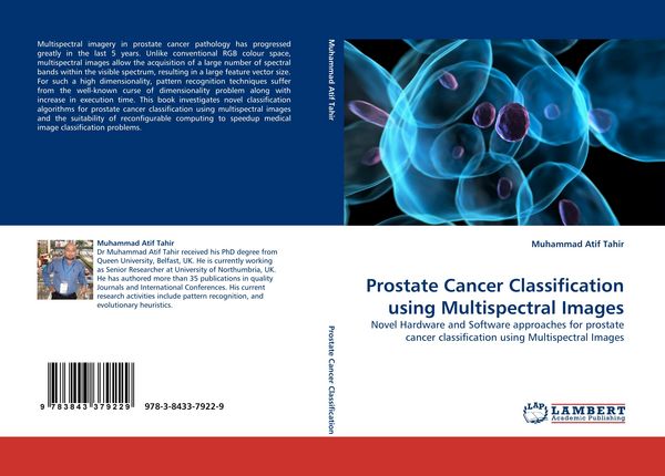 Produktbild: Prostate Cancer Classification using Multispectral Images