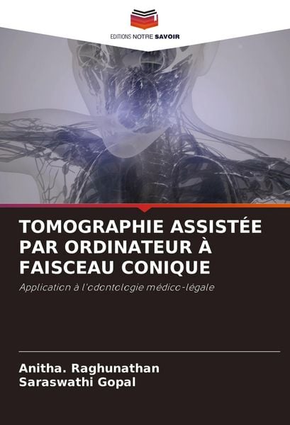 Produktbild: Tomographie Assist&eacute;e Par Ordinateur &Agrave; Faisceau Conique