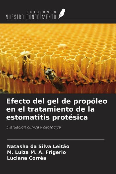 Produktbild: Efecto del gel de prop&oacute;leo en el tratamiento de la estomatitis prot&eacute;sica