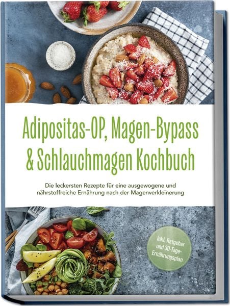 Produktbild: Adipositas-OP, Magen-Bypass & Schlauchmagen Kochbuch: Die leckersten Rezepte f&uuml;r eine ausgewogene und n&auml;hrstoffreiche Ern&auml;hrung nach der Magenverkleinerung - inkl. Ratgeber und 30-Tage-Ern&auml;hrungsplan