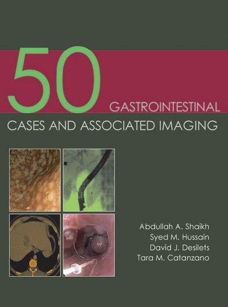 Produktbild: 50 Gastrointestinal Cases and Associated Imaging