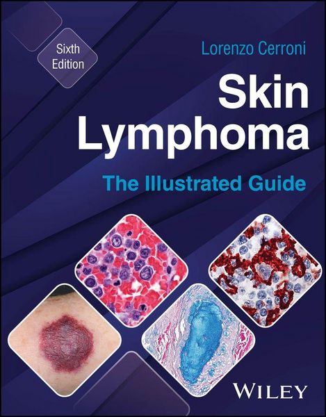 Produktbild: Skin Lymphoma