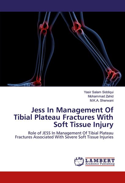Produktbild: Jess In Management Of Tibial Plateau Fractures With Soft Tissue Injury