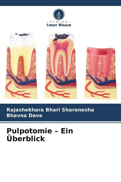 Produktbild: Pulpotomie - Ein &Uuml;berblick