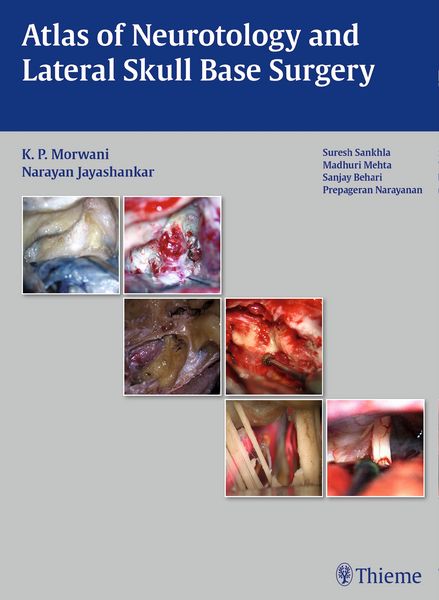 Produktbild: Atlas of Neurotology and Lateral Skull Base Surgery