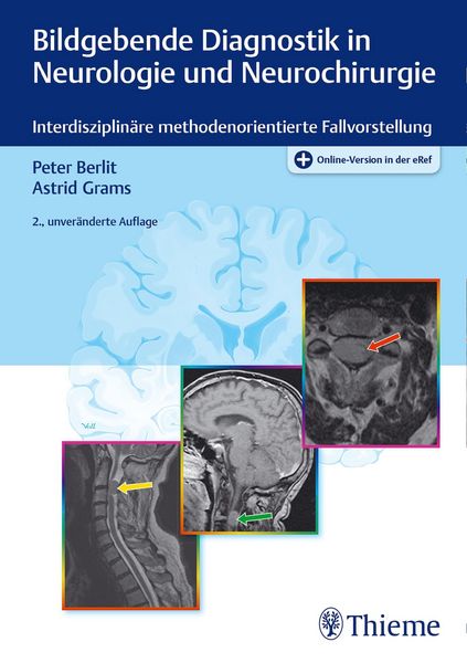 Produktbild: Bildgebende Diagnostik in Neurologie und Neurochirurgie