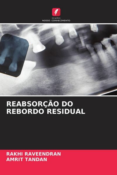 Produktbild: Reabsor&ccedil;&atilde;o Do Rebordo Residual
