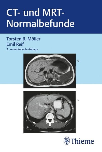 Produktbild: CT und MRT Normalbefunde