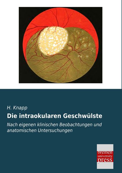 Produktbild: Die intraokularen Geschw&uuml;lste