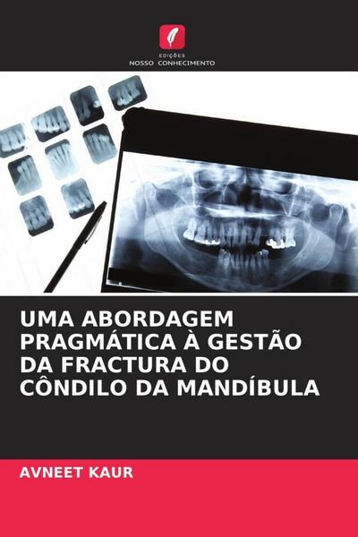 Produktbild: Uma Abordagem Pragm&aacute;tica &Agrave; Gest&atilde;o Da Fractura Do C&ocirc;ndilo Da Mand&iacute;bula