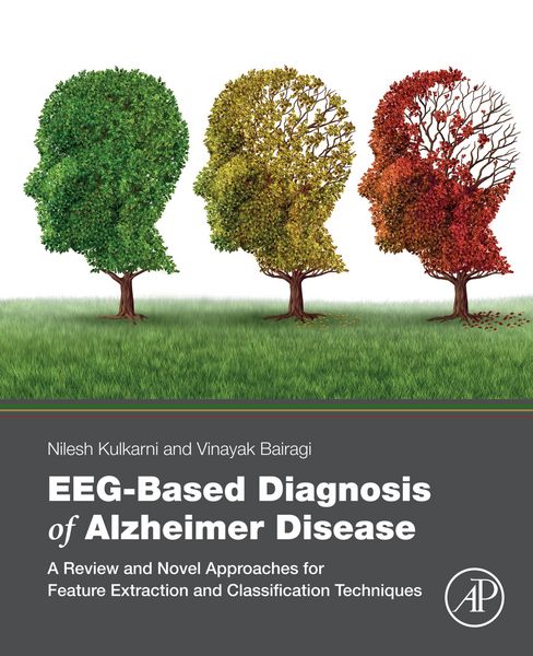 Produktbild: EEG-Based Diagnosis of Alzheimer Disease
