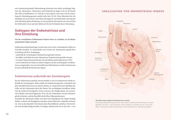 Produktbild: Endometriose &ndash; Die untersch&auml;tzte Krankheit