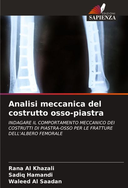 Produktbild: Analisi meccanica del costrutto osso-piastra