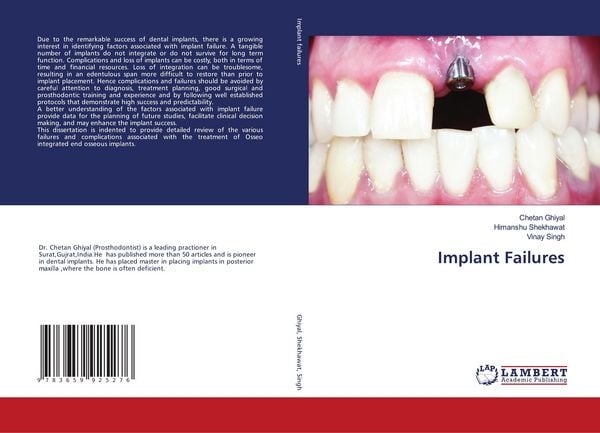 Produktbild: Implant Failures