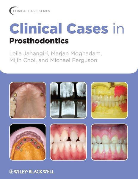 Produktbild: Clinical Cases in Prosthodontics