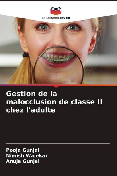 Produktbild: Gestion de la malocclusion de classe II chez l'adulte