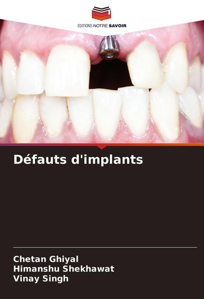 Produktbild: D&eacute;fauts d'implants