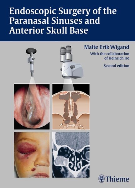 Produktbild: Endoscopic Surgery of the Paranasal Sinuses and Anterior Skull Base
