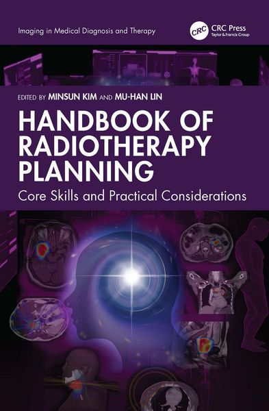 Produktbild: Handbook of Radiotherapy Planning