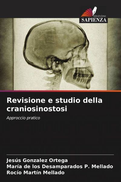 Produktbild: Revisione e studio della craniosinostosi