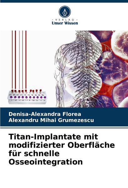 Produktbild: Titan-Implantate mit modifizierter Oberfl&auml;che f&uuml;r schnelle Osseointegration