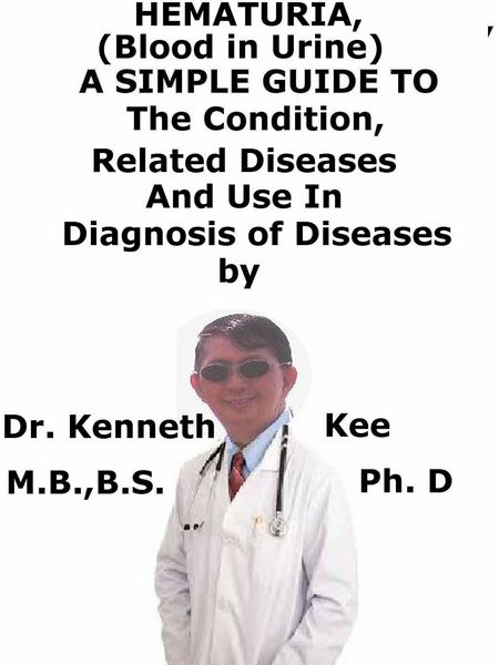 Produktbild: Hematuria, (Blood in Urine) A Simple Guide to The Condition, Related Diseases And Use in Diagnosis of Diseases