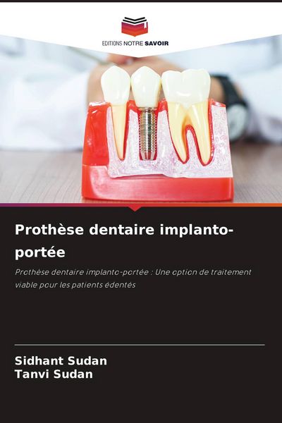 Produktbild: Proth&egrave;se dentaire implanto-port&eacute;e