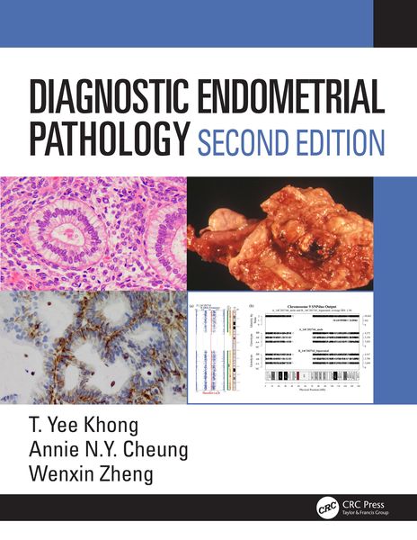 Produktbild: Diagnostic Endometrial Pathology 2E